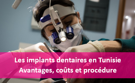 implants dentaires tunisie